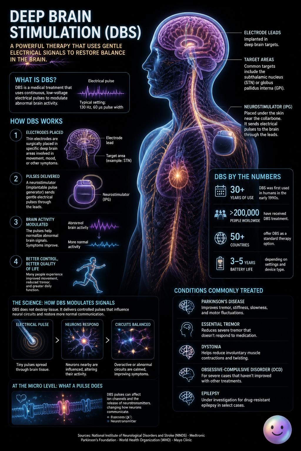 Deep brain stimulation